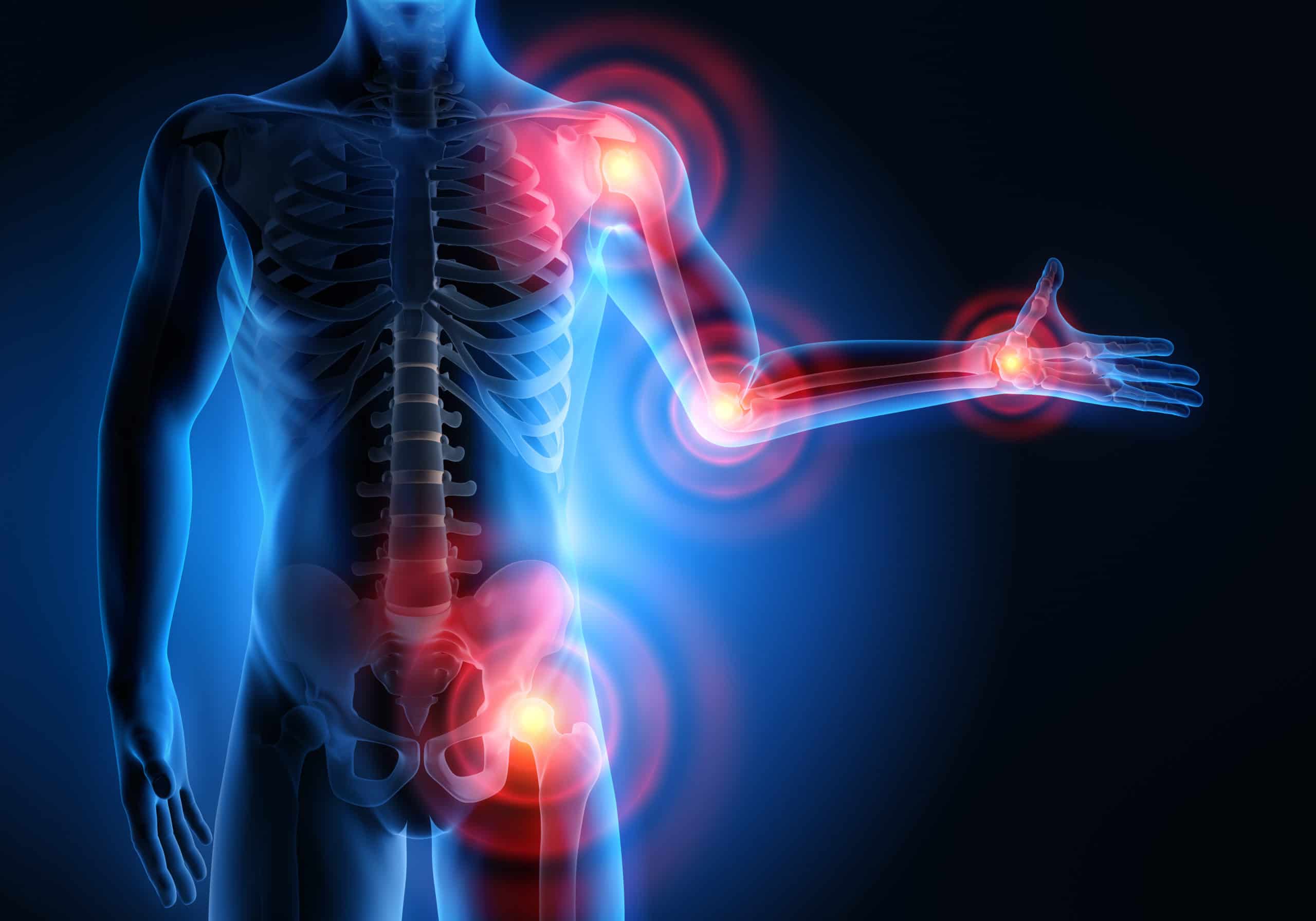 Chronic Pain Causes And Treatment Northeast Spine And Sports Medicine